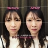 小顔矯正ビフォーアフター「【小顔矯正ビフォーアフター２５】」