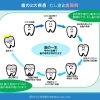 歯の一生とむし歯・歯周病―早めの治療で歯の寿命を延ばしましょう