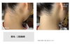 「男女とも人気♪うなじ脱毛のビフォーアフターをご紹介【大分市/大在/うなじ脱毛/脱毛サロン】」