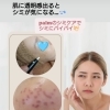 今の季節がシミケアオススメシーズン🌼組織を傷つけない低周波で､しみ部分のみ施術💆palmのシミケア❇️