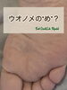 「ウオノメの“め”」