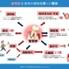 歯周病と全身の病気の深い関係―今できる予防のポイント
