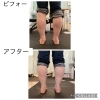 外反母趾の『黒幕』は？