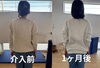 変化「側弯症で悩む女性に対するコンディショニング」