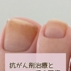 【がん患者サポート】抗がん剤治療と爪の回復