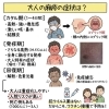 麻疹（はしか）