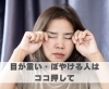 目が重い・ぼやける人はココ押して「目が重い・ぼやける人はココ押して【豊明市前後駅からすぐの鍼灸院】」