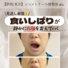 顔伸び・エラはり・頭痛の原因はコレ😱⁉️