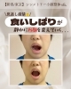 「顔伸び・エラはり・頭痛の原因はコレ😱⁉️」