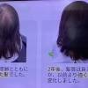 髪質の再生を目指す。2年後も3年後も強く太い髪を目指すなら、素髪ケアを始めてみませんか？