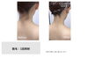 「女性人気No.1♪うなじ脱毛ビフォーアフター【大分市/大在/脱毛サロン/うなじ脱毛】」