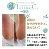 触って感動After!ツルツルかかと