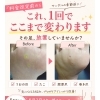 サンダル🩴の季節前に、足のケア始めてみませんか？大阪駅・梅田駅から2駅にある足のトラブルに特化したフットケアサロン✨️野田阪神からすぐにあり、帰りにお買い物もできちゃう！