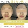 ファンデに頼らない素肌へ。光フォトフェイシャル初回6,000円のご案内【米子・松江・境港・伴走型エステ】