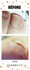プロの爪切り　Before「自分では爪切りが難しい😔💦足のトラブルに特化したフットケアサロン👣大阪駅・梅田駅から2駅にあります🚃野田阪神からもすぐ！」