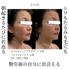 【数年前の顔にもどりたい✨】そんな想いを叶えてくれるのがプラズマフェイシャル🙌シワもたるみも毛穴も年齢を重ねるにつれて悪目立ちしてきます💦小鼻もキュッと小さくお顔全体を若返らせましょう💫（松山市枝松T i A M）