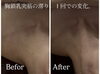 短時間でここまで変わる！「首の横ラインがすっきり。胸鎖乳突筋の“滞り”が1回でここまで変化しました」