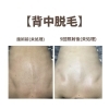 背中脱毛beforeafter