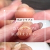急な爪のトラブルの原因【福井/自爪育成/ネイル】