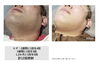 「ヒゲ脱毛でトーンアップ♪若見えをめざしませんか？【大分市/大在/メンズ脱毛/ヒゲ脱毛】」