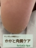 意外と見られているよ👀「【角質ケア】サンダルの季節！かかと、大丈夫？」
