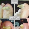 厚くなった爪に悩んでいませんか❓️足トラブルに特化したフットケアサロン👣大阪駅から2駅にあり、完全予約制🏡