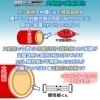 大動脈の動脈硬化をイラストで解説しました【尼崎・内科】
