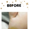 素足👣になる前に足のメンテナンスしませんか⁉️タコ・うおの目、厚くなった爪にお悩みの方は大阪駅・梅田駅から2駅にある足トラブルに特化したフットケアサロンへ✨️野田阪神からすぐにあります🚶‍➡️
