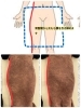 理想のボディラインへ 輝く女性におすすめ「産後矯正の通い方｜骨盤まわりのお悩みがある方へ」