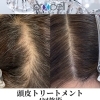 プロセルセラピーズ　施術の特徴について