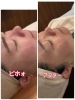 お肌が変わる感動「女性のお顔そりって、どんなことをするの？」