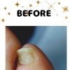 違和感があるたこ・うおの目のケアしませんか❓️足のトラブルに特化したフットケアサロン👣大阪駅・梅田駅から2駅にあり、野田阪神からすぐにある個室サロン🏡ゆったりケアしませんか✨️