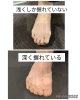 握れる見た目だけの話ではありません。「足指で「グー」ができない人と腰痛の関係」