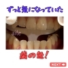 「ずっと気になっていた歯の色を、ホワイトニングで自慢の口元へ」