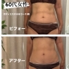 年齢を重ねても変われる✨巡りを整えるケア