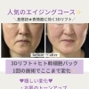 70代のお客様も笑顔に＊ヒト幹細胞エステで「私じゃないみたい！」