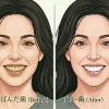 【八王子/京王八王子/完全個室/脱毛サロン】ホワイトニングを美容習慣にプラスしませんか？🦷🤍🫧