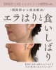 「エラはりは遺伝じゃない🧬 【新潟/村上市の小顔整体/小顔矯正/全身の歪みを整え戻りの少ない美小顔へ/姿勢改善/自律神経/整顔】」