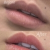 【ローマピンク Before→After👄】 海南市エステサロン
