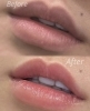 劇的変化!輝き宿る理想の唇「【ローマピンク Before→After👄】 海南市エステサロン」
