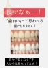 「「歯白いね！」と言われる口元へ。人から見られているホワイトニング症例」