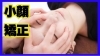 「結婚式前に「少しでも顔をシャープに見せたい！」というご相談」