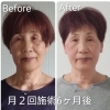 お顔のお悩みあきらめないで！こんなに変われます！