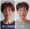 印象変わる！変化に驚く施術効果「お顔のお悩みあきらめないで！こんなに変われます！」