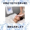 水素水ピーリング「ハイドロスプラッシュ」で毛穴洗浄ケア