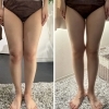 月1オールハンドケアで実感する後ろ姿と脚の変化