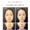 6ヶ月で変わる、その先も育てる光糸リフト