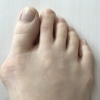 外反母趾でお困りの方へ…。普段のトレーニングやケアで痛みの軽減は可能です。