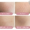 お子さんの「自己処理」ちょっと待って！カミソリ負けとチクチクの話
