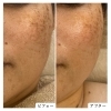 【40代】1回のフェイシャルでここまで✨